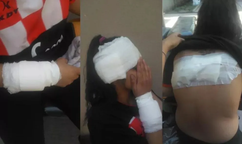 VIDEO: La justicia tucumana ordenó la prisión preventiva para la agresora de Zoe