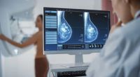 Nuevas recomendaciones: las pruebas de mamografía deberían comenzar a los 40