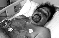 Dejaron en terapia intensiva a un comerciante de Burruyacu tras robarle